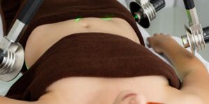 Best Laser Treatment For Anal Fissure